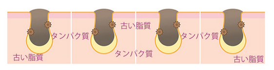 毛穴の黒ずみの正体は「皮脂」と「タンパク質」