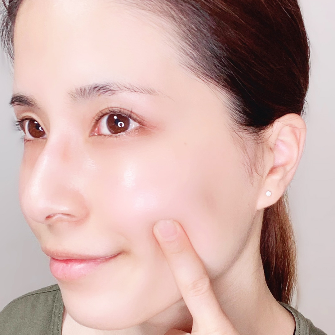 ほうれい線が気になりだす30代