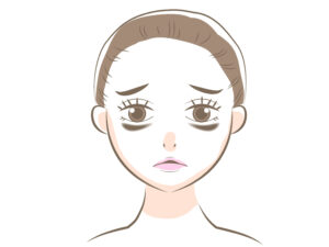 目の下のクマは３種類あった！あなたのクマはどれ？タイプ別お手入れを徹底解説