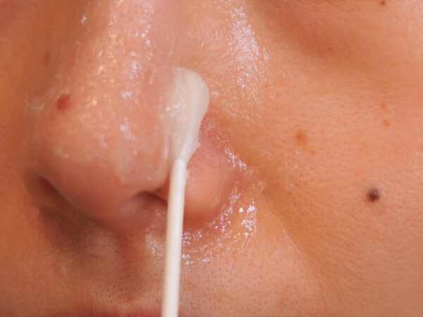 ラップを外して、綿棒でワセリンをぬぐいます。