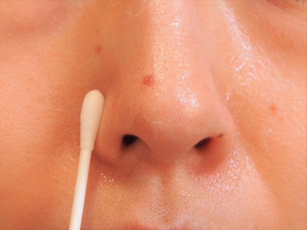 いちご鼻にはワセリンと綿棒がいいってホント その噂 実際に検証してみた