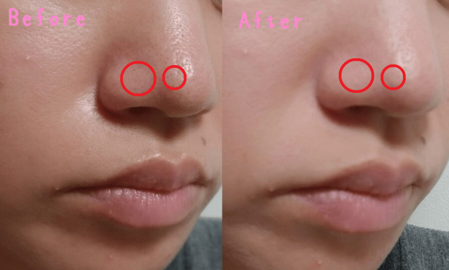 洗顔ビフォーアフター