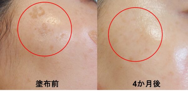 それは何ですか？