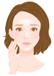 スキンケアの後ベタベタしない？朝晩の正しいスキンケアで解決☆