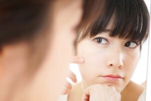 ニキビ跡はどうしたら消える？自力で治せる？家にあるもので消す方法も紹介