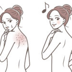 背中にも角栓ができる？背中が汚く見える原因とツルツルにするケアをご紹介