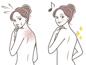 背中にも角栓ができる？背中が汚く見える原因とツルツルにするケアをご紹介