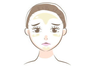 顔の脂の原因と対策！放っておくと顔が臭くなる!?おすすめの洗顔や化粧水もご紹介