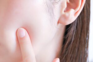 ニキビができない人の特徴は？できる人との違いを徹底分析！