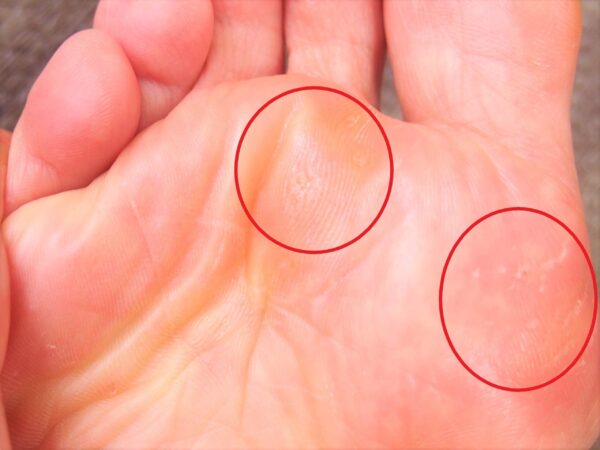 ひまし油を塗った直後の状態