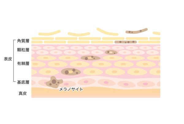メラニン毛穴ができるメカニズム