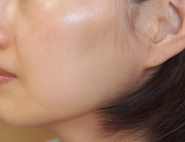 肌をウチワサボテンオイルでケア