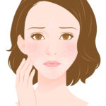 顔の皮むけの原因と対策!カサカサ肌、ポロポロ剥けるのはどうして?