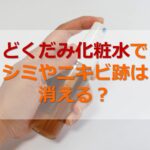【実践レポ】ドクダミのすごい効能◎どくだみ化粧水の作り方とその効果も紹介