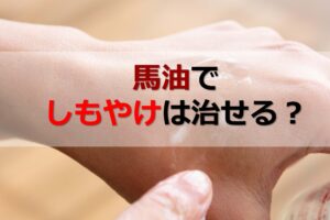 しもやけは馬油で治せる？しもやけの原因や、馬油がしもやけにもたらす2つの効果を解説