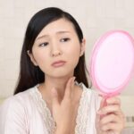 首ニキビの原因と対策！繰り返さないために知っておきたい予防＆改善法