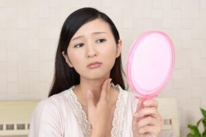 首ニキビの原因と対策！繰り返さないために知っておきたい予防＆改善法