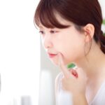 ニキビができる人は将来綺麗な肌になるって本当?その原因とニキビの対処法を徹底解説