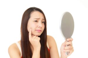 ニキビに絆創膏を貼ると悪化する？ニキビパッチはOK？正しい対処法を解説