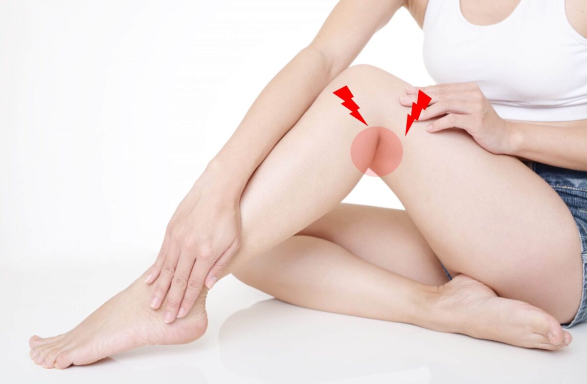 膝裏がかゆいときの原因とは？繰り返す皮膚炎や湿疹が出たときの対処法を紹介