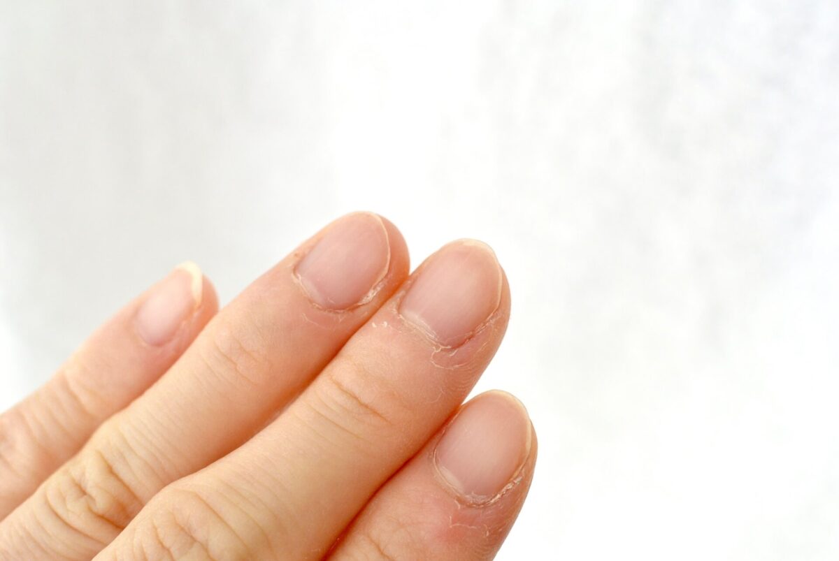 爪が乾燥する原因は？起こるトラブルや保湿の方法を徹底解説
