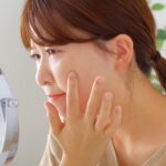 ニキビ跡はどうしたら消える？自力で治せる？家にあるもので消す方法も紹介