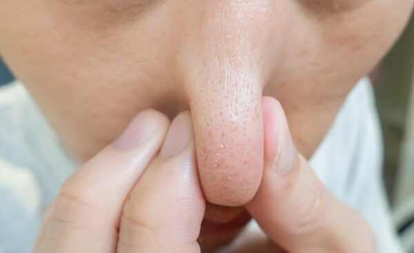 後悔を生むNG毛穴ケア