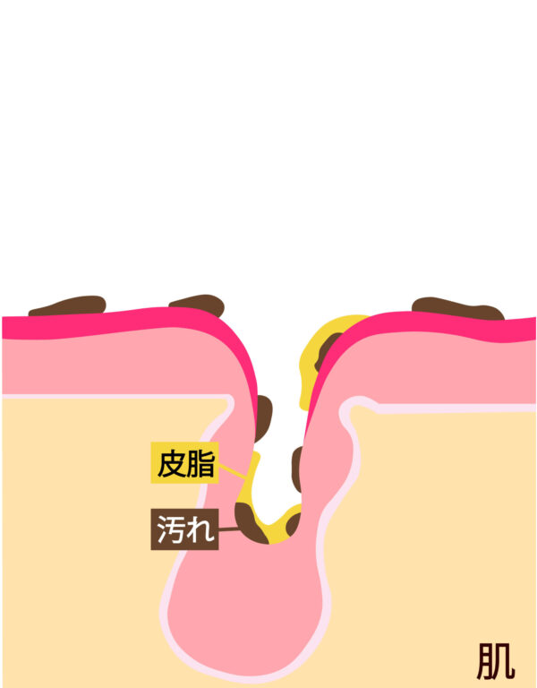 メイクを長時間したまま肌トラブル