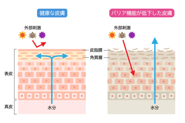 肌荒れニキビかゆみなどが続くとバリア機能が低下する