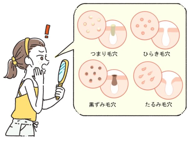 あなたの毛穴が目立つ原因は3つのタイプのどれ？