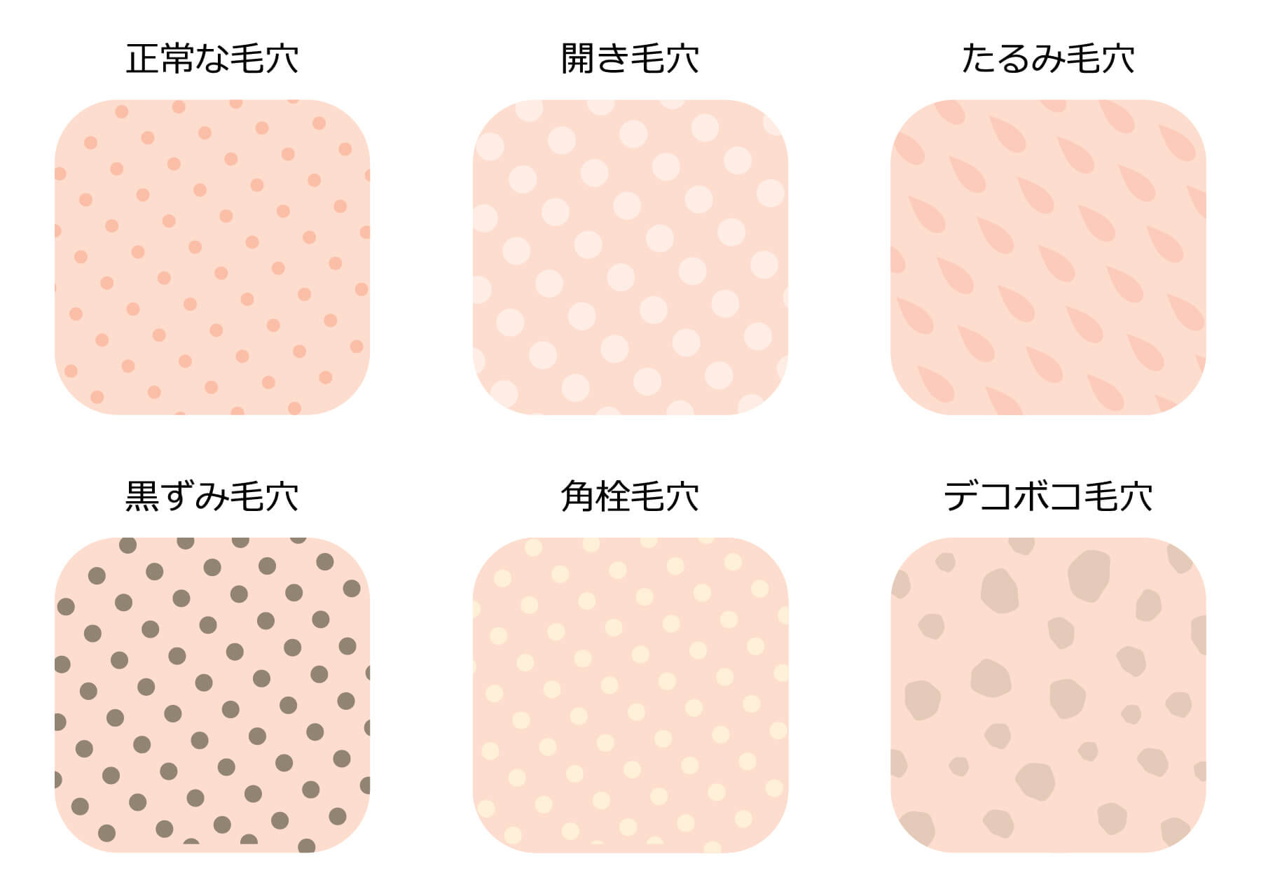 まずは鏡でチェック！あなたの「毛穴落ち」はどのタイプ？