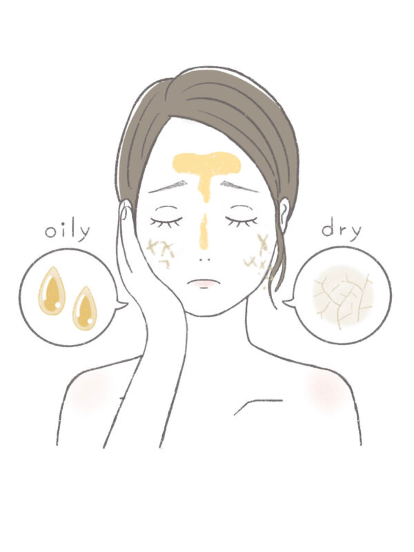 実は保湿が足りていない「インナードライ肌」の可能性