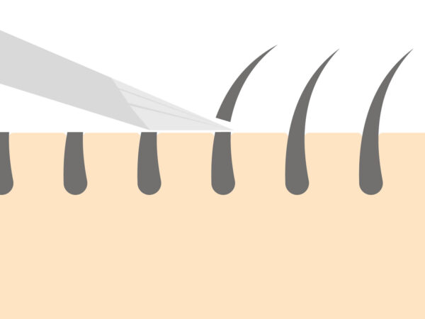 「剃ると濃くなる」という噂