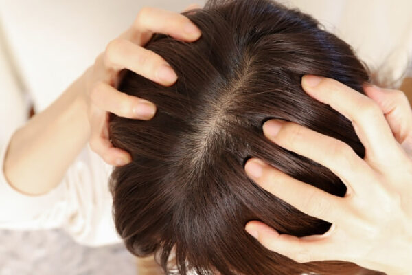 薄毛セルフチェック