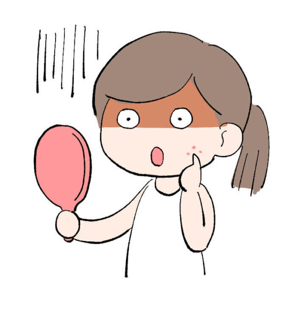 やり方次第では逆効果！サウナでニキビが悪化する3つのケース