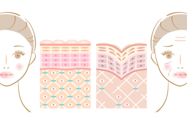 あなたのシワはどれ?4つのタイプ別セルフチェック