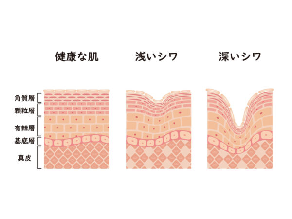 原因3:加齢によるハリ・弾力の低下