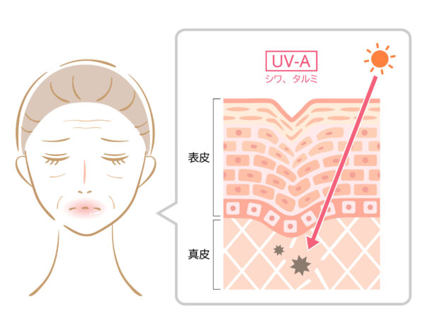 原因2:紫外線による光老化