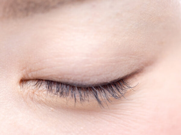 原因1:皮膚の薄さと乾燥