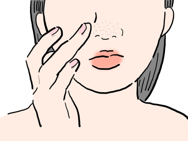 そもそも「毛穴落ち」とは？あなたの頬で起きていること