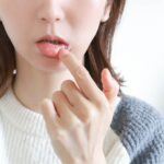 もしかして唇の日焼け？ヒリヒリ・皮むけの正しい治し方と予防策を徹底解説