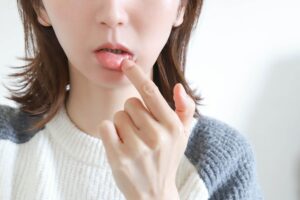 もしかして唇の日焼け？ヒリヒリ・皮むけの正しい治し方と予防策を徹底解説